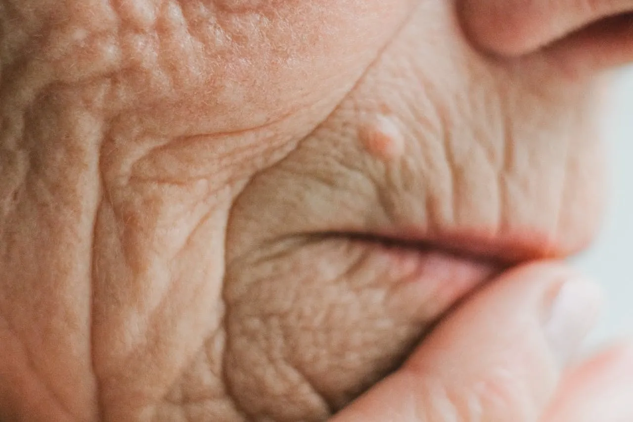 Die Schmeterlingspflege - Ambulanter Pflegedienst - Nahaufnahme des Gesichts einer älteren Dame